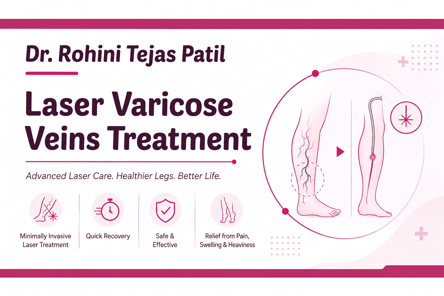Best Laser Varicose Veins Treatment in Nanded